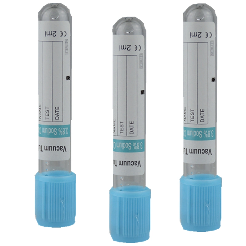 Prix usine de tube de collection de sang du citrate sodique d'animal familier 3,2%